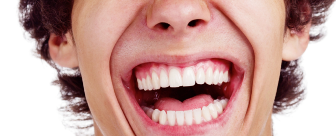 Ein junger Mann lacht und zeigt dabei seine Zähne.