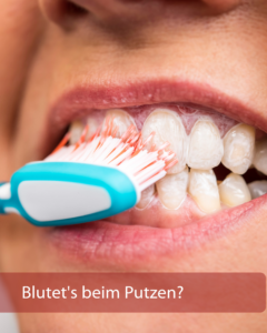 Zahnfleischbluten – wirklich harmlos?